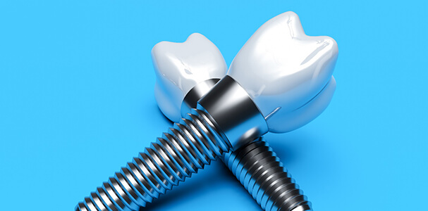 A pair of dental implants in Waupun and Beaver Dam