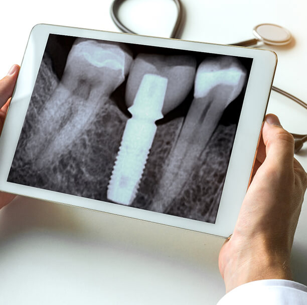 Implant dentist in Waupun and Beaver Dam holding a tablet