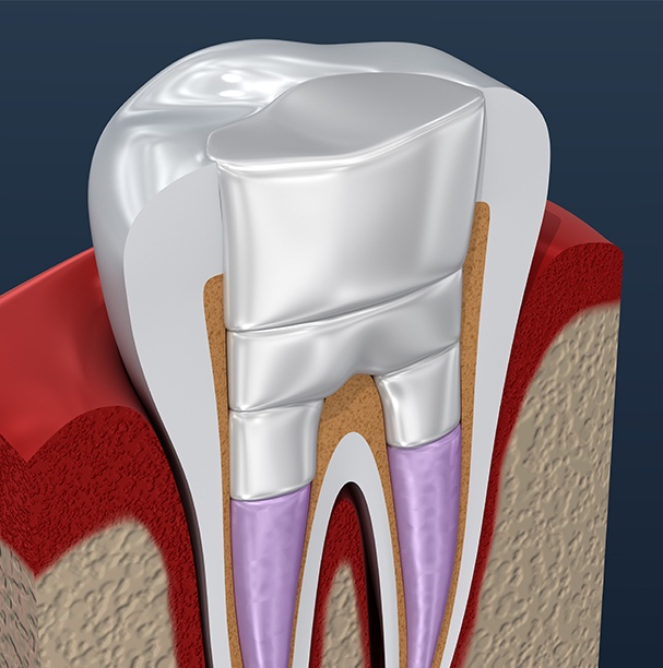 illustration of inside of tooth