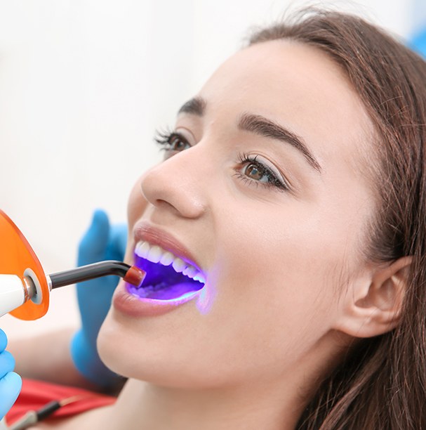 woman having sealants placed