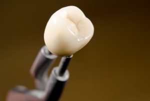 Same-day dental crowns in modern office