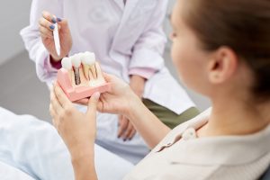 Dentist pointing with a pen at a model of implants held by the patient