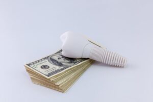Dental implant model on a stack of cash